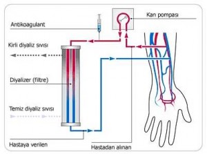 Diyaliz Nedir Nasıl Yapılır Hemodiyaliz ve Diyaliz Sistemleri