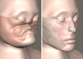 3462_art.face.transplant.clinic