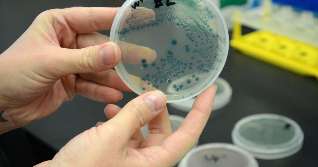 Et Yiyen Bakteri Enfeksiyonu Hakkında Genel Bilgiler » Bilgiustam