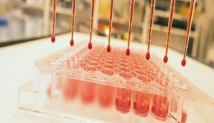 13521_vials-blood-test-bizsiziz.com_-300x173.jpg